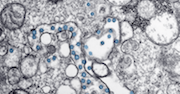 CDC-provided photo of coronavirus 